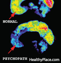 A pszichopatikus agy érdeklődési körébe tartozik a kutatás annak meghatározására, hogy a pszichopaták hogyan gondolkodnak, de mennyire különböznek a pszichopaták agya?