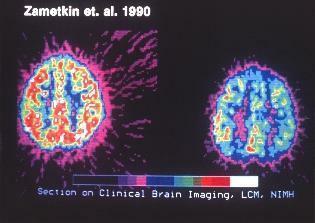 klinikai agyi képalkotó vizsgálat az adhd számára