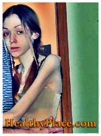 Ebben az önkárosító fotóban az anorexiavel küzdő lány az önkárosodással is foglalkozik, mivel testének dörömböl és zúzódik.